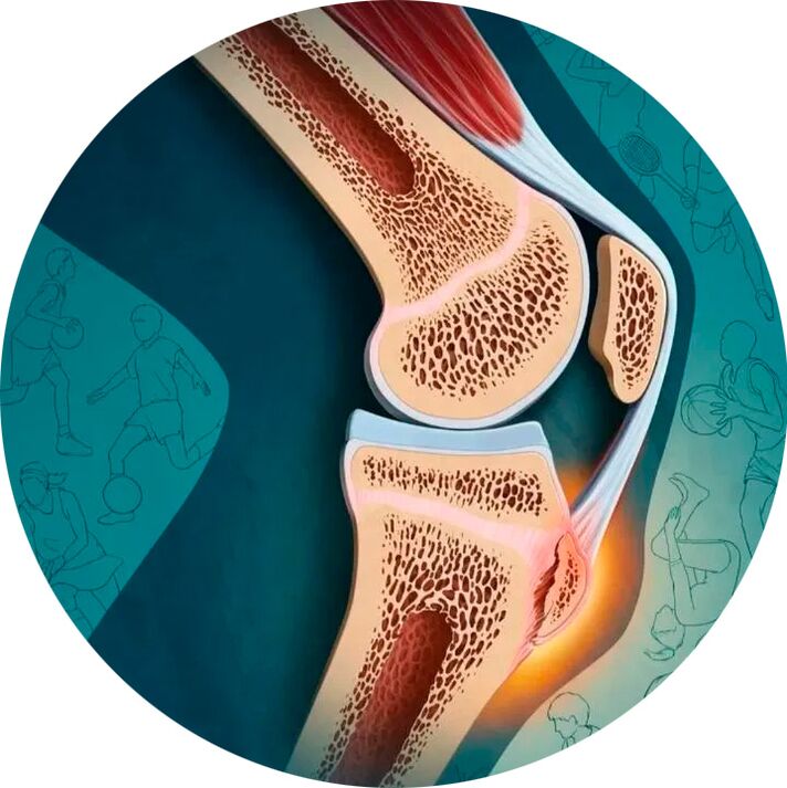 Структурата на ставата и околните тъкани