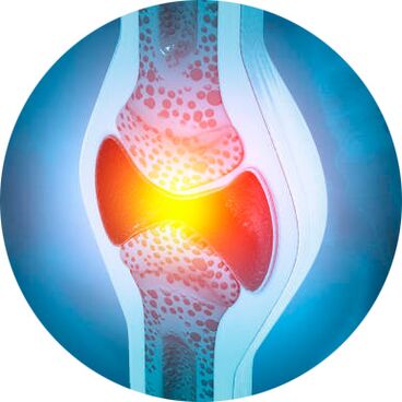 процес на възстановяване на ставите с Icexin гел